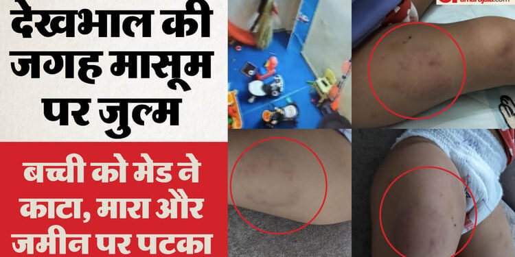 15 माह की बच्ची से क्रूरता: थप्पड़ मारे, जमीन पर पटका.. जांघ पर काटा, हैवानियत करने वाली को भेजा बाल सुधार गृह