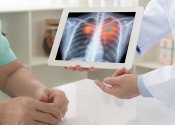 Lungs Test: घर बैठे जानिए कितने स्वस्थ हैं आपके फेफड़े? इस टेस्ट से मिनटों में मिलेगा रिजल्ट वो भी बिल्कुल फ्री