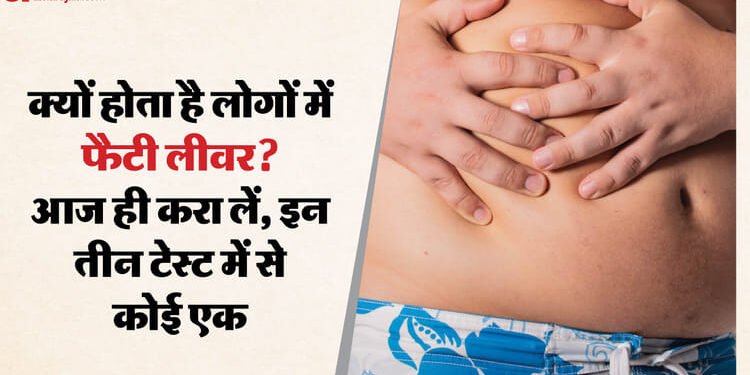 Fatty Liver: जीवन बन रहा है आलसी तो लीवर हो रहा फैटी, इन लक्षणों पर ध्यान दें; बचने के हैं बस कुछ ही उपाय
