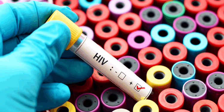 HIV: दिल्ली में एचआईवी के 60 हजार मरीज, राष्ट्रीय औसत से अधिक है राजधानी में प्रसार दर; पुरुषों की संख्या अधिक