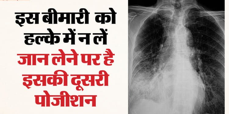 बढ़ता जा रहा खतरा: दिल्ली में हार्ट अटैक के बाद इस बीमार से मर रहे सबसे अधिक लोग, बच्चे होते हैं ज्यादा शिकार