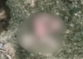 दरभंगा DMCH में मानवता तार-तार: नाले में पड़ा नवजात का शव, कुत्तों ने नोच-नोचकर खाया; दिल दहला देगा मामला