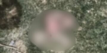 दरभंगा DMCH में मानवता तार-तार: नाले में पड़ा नवजात का शव, कुत्तों ने नोच-नोचकर खाया; दिल दहला देगा मामला