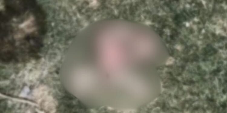 दरभंगा DMCH में मानवता तार-तार: नाले में पड़ा नवजात का शव, कुत्तों ने नोच-नोचकर खाया; दिल दहला देगा मामला